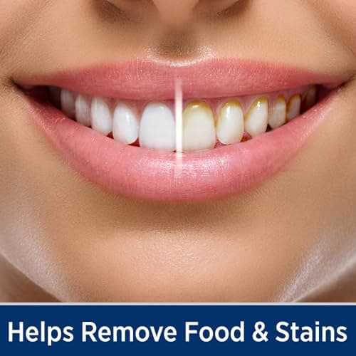 Ontel Miracle Smile Water Flosser for Teeth&Gum Health, Unique H-Shaped Flossing Head&4 Water Jets, Cordless Water Flosser Features 360° Cleaning&3 Pressure Modes, USB Rechargeable Dental Floss, White 8