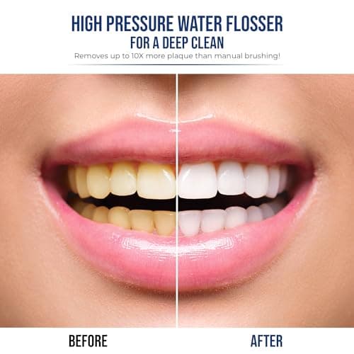 Optum Duo Electric Toothbrush Replacement Heads 2-Pack - Compatible with Optum Duo 2 in 1 Flossing Toothbrush - Includes Brush Head Covers - Black 5