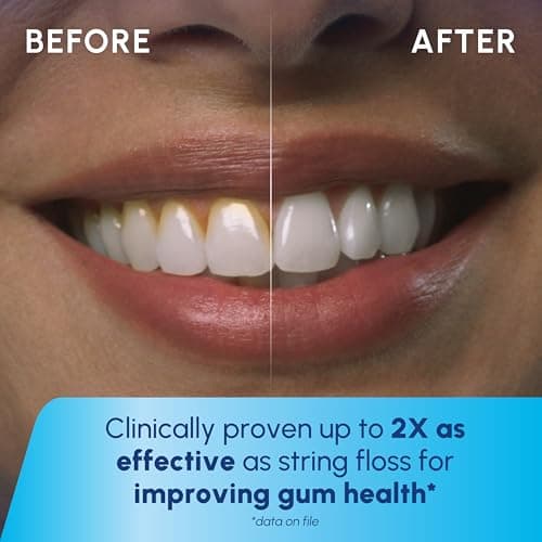 Waterpik Cordless 1100 Rechargeable Portable Water Flosser for Teeth Cleaning and Flossing, Travel, Braces Care, Healthier Gums, Waterproof for Shower, ADA Accepted, WF-30CD White, Packaging May Vary 5