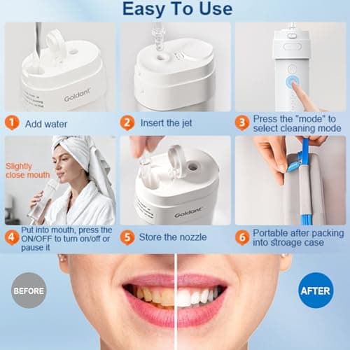 GOLDANT 2026 New Portable Water Flosser for Teeth, 4 Modes & 4 Intensity Levels, Mini Small Design with Exquisite Travel Case, Removable Tank, IPX7 Waterproof, Cordless Dental Oral Irrigator (Black) 9