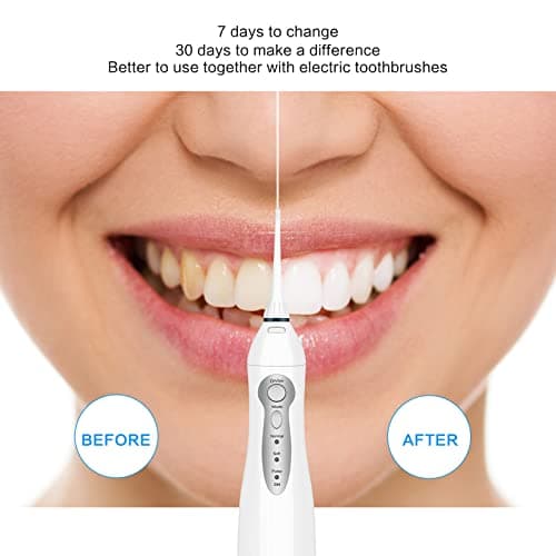 TOVENDOR Electric Water Flosser, Cordless Rechargeable Dental Oral Irrigator IPX7 Waterproof 300ML Travel Water Teeth Cleaner with 5 Tips for Braces Care Teeth Gums Cleaning, Home Office Daily Use 7