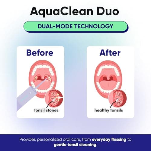 SOMETHING NICE AquaClean Duo Water Flosser - Portable, Waterproof, Include Nozzle, Magnetic Charger & Travel Bag | Dentist Designed Cordless Flosser for Teeth Cleaning Ideal for Braces (Pastel Purple) 6