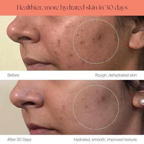 Canopy Bedside Evaporative Humidifier - 36 HR Run Time, 2.5L Capacity - No Mist - Help Alleviate Symptoms of Allergies, Flu, Cold, Dry Skin Includes Humidifier, Unwind Aroma, Filter - White 5