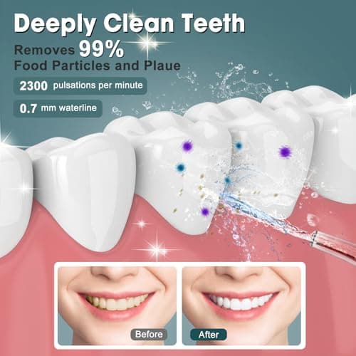 NIMMU Water Flosser for Teeth Picks, Mini Cordless Portable Water Dental Flosser with 160ML Water Tank, Infinitely Knob Mode IPX7 Waterproof, Lightweight, Electric Water Flosser for Travel - Black 6