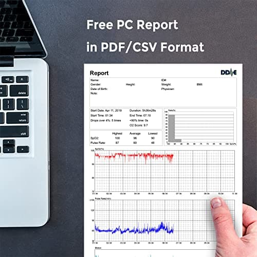 Wellue O2Ring Pulse Oximter, Bluetooth SPO2 Blood Oxygen Saturation Monitor - Wearable O2 Ring Sensor with Vibration Reminder, Free APP & PC Report, Rechargeable 7