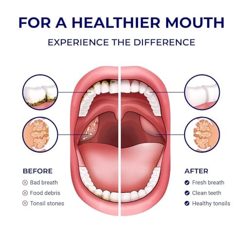 Oravix 100 ml Manual Oral Irrigation Bottle for Teeth & Gum Care, Portable Mouth Cleaner, Tonsil Debris Removal Tool, Child-Friendly Dental Rinse Device, Cordless & Battery-Free 7