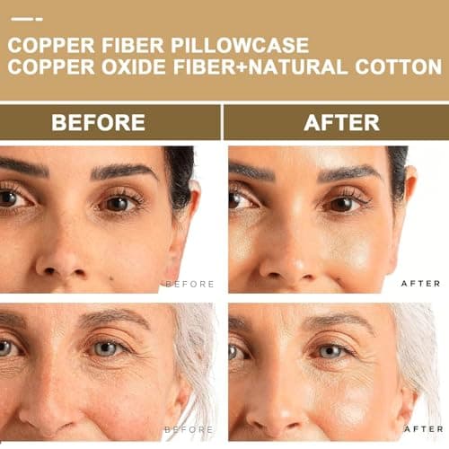 100% C opper Compression Copper Pillowcase for Beauty, Skin, Wrinkles, Fine Lines, and Hair Guaranteed Highest Copper Pillow Case 4