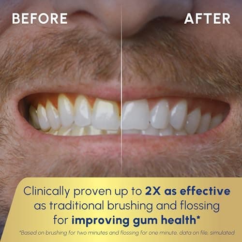 Waterpik Sonic-Fusion 2.0 Professional Flossing Electric Toothbrush with Water Flosser Combo Two In One, For Daily Gum Care and Cleaning Teeth, Braces, Implants, White SF-04CD010-1, Packaging May Vary 5