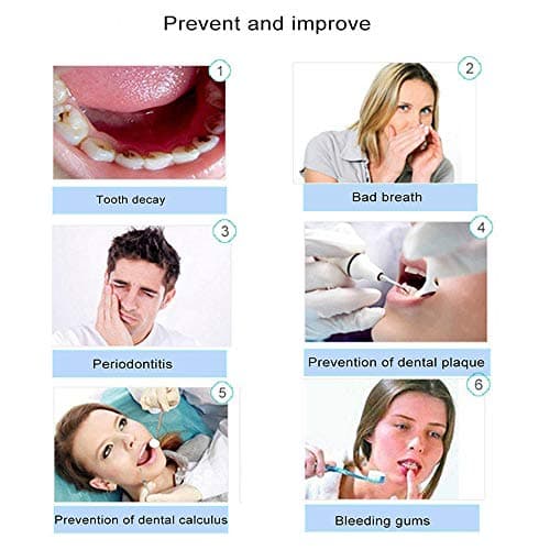 Portable Manual Water Dental Flosser – Non-Electric, Cordless Oral Irrigator with Air Pressure Technology, Easy to Use for Teeth Cleaning at Home & Travel 6